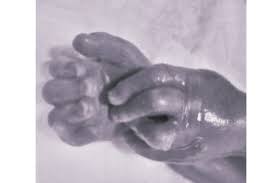 Fundraiser by Ellie-Mae Price : Archie-Jay Freddie Ian Eccles