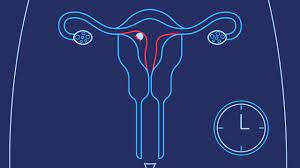 Pregnancy Testing Early Pregnancy Signs Planned Parenthood Of The St Louis Region And Southwest Missouri