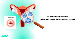 Image result for Cervical Cancer Screening