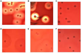 Chromogenic media enable the selective detection of s. Frontiers Identification And Characterization Of Staphylococcus Aureus Strains With An Incomplete Hemolytic Phenotype Cellular And Infection Microbiology