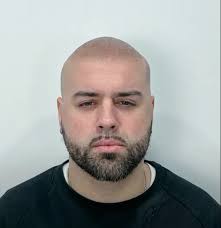 Oscar Arango Micropigmentación capilar