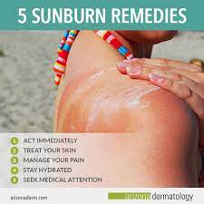 5 Ways To Treat Your Sunburn | Arizona Dermatology