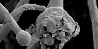 Ante una fuerte presencia de hongos negros, cepillar las manchas en paredes y piso. Hongo Negro El Nuevo Sintoma Del Coronavirus Que Puede Ser Mortal La 100