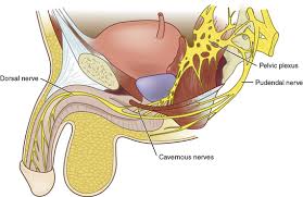 Image result for Radical Prostatectomy