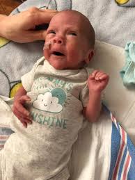 Hello. My name is Melissa but I go by missy. My son, Noah, was born at 22  weeks gestation. He is now 30 weeks (about to be 2 months old). I want