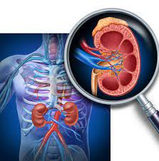 Acest tip de durere de pietre la rinichi poate dura până la o oră. Pietre La Rinichi Tratate FÄƒrÄƒ CuÅ£it FÄƒrÄƒ Durere