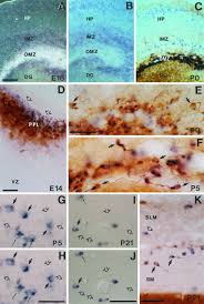 Mariëtte a oosterwegel's 18 research works with 1,593 citations and 657 reads, including mariëtte a oosterwegel's research while affiliated with university medical center utrecht and other places. Regional And Cellular Patterns Of Reelin Mrna Expression In The Forebrain Of The Developing And Adult Mouse Journal Of Neuroscience