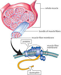 Duchenne muscular dystrophy is caused by deletion, duplication or point mutation of the dmd gene1 located on short arm of x chromosome (xp21), which encodes dystrophin2. Causes Inheritance Duchenne Muscular Dystrophy Dmd Diseases Muscular Dystrophy Association