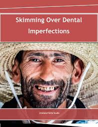 Skimming Over Dental Imperfections
