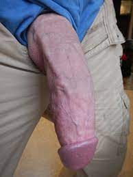 Guystricked
