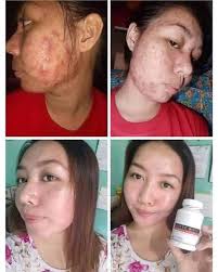 Health skin Kenya added a new photo.