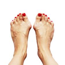 Anfänglich behilft man sich gerne mit komfortablem schuhwerk und einlagen. Hallux Valgus Orthopadische Praxis Leipzig