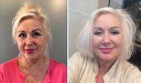 How Sarah Ferguson 'facelift' gave actress Hetty Baynes the courage to act  again