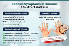 Image result for scabies on humans