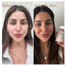 Natural Tanning Gummies