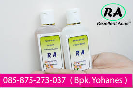 Cara Mengatasi Jerawat Pasir Di Muka Cara Mencegah Timbulnya Jerawat Pada Wajah Cara Mencegah Timbulnya Jerawat Dan Menghilangkan Jerawat Obat Jerawat Wajah