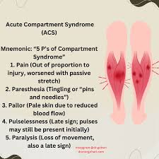 Image result for Compartment Syndrome