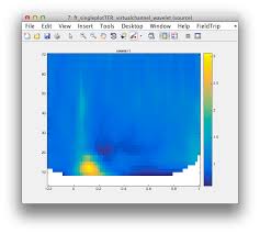 2006 spm students,what's you result? Fieldtrip Beamformer Demo Fieldtrip Toolbox