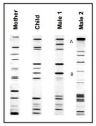 Sample collection, dna extraction, absorption or intensification and investigation results are significant advances. Solved A Results From A Paternity Test Using Dna Fingerp Chegg Com