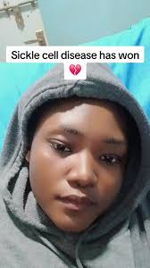 Sickle Cell Disease: Understanding Its Impact