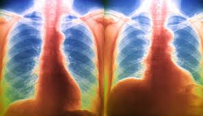 Lvlupfit.comwhat organ in just underbthe bottom left rib. Diaphragm Anatomy Function And Abnormalities