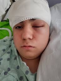 Ed Sweeny's Brain Surgery and Recovery Support