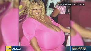 Top 15 female athletes with the biggest breasts. Woman S Breasts Weigh 89 Pounds Cnn Video