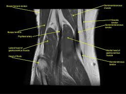 What is the main function of the bicep and triceps? Ppt Biceps Femoris Tendon Powerpoint Presentation Free Download Id 3034006