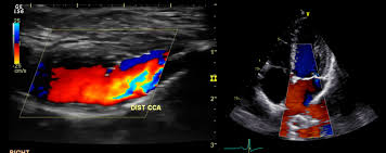 Nuestro servicio de ecodoppler cardíaco a domicilio en capital federal o zona sur, norte y oeste es muy útil existen diferentes tipos de eco doppler, nosotros realizamos las siguientes: áˆ Ecodoppler Cardiaco A Domicilio En Capital Federal Y Bs As