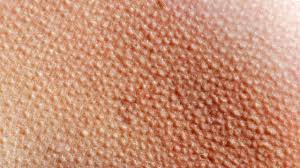 Why Do We Get Goosebumps Youtube For the 1499 people in this statistical metaphor, goosebumps are completely involuntary. why do we get goosebumps