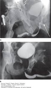 Image result for Genitourinary Trauma