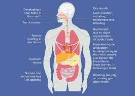 Probiotics For Heartburn Natural Supplements For Gerd Praxid