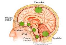 Image result