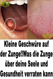 Kleine Geschwure Auf Der Zunge Was Die Zunge Uber Deine Seele Und Gesundheit Verraten Kann Seele Und Gesundheit Gesundheit Gesundheit Und Wohlbefinden