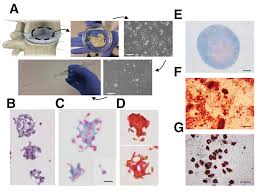 Maybe you would like to learn more about one of these? In Vitro And In Vivo Evaluation Of Discogenic Cells An Investigational Cell Therapy For Disc Degeneration The Spine Journal
