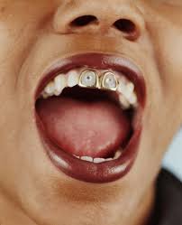 Winner of rupauls drag race uk � for bookings, contact and all enquiries jeremy@intentionmanagement.com. Tooth Gems Charli D Amelio Kendall Jenner Teeth Accessories Gen Z S Latest Fashion Fixation