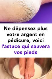 Ne Depensez Plus Votre Argent En Pedicure Voici L Astuce Qui Sauvera Vos Pieds Feet Care Easy Workouts Natural Health Care