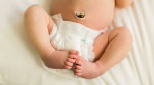 Think of it as a last souvenir of your baby's uterine stay: Baby Umbilical Cord Care