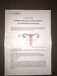 Er det noen her som har hatt problemer med å bære fram et barn etter konisering? Ann Linda Jeg Har Fatt Ny Time Til Operasjon