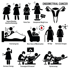 I sintomi dell'endometriosi più forti si manifestano tra i 25 e i 30 anni. Tumore Dell Endometrio Sintomi E Diagnosi Stetoscopio Rivista Medica Online