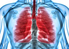 Cancer has not spread to the lymph nodes. Rethinking How We Approach Stage 3 Lung Cancer Treatment