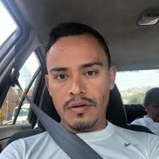 Artritis mutilante Artritis mutilante es una forma muy grave pero rara de  la artritis donde se destruye el hueso y cartílago en las articulaciones,  lo que conduce a la deformación de las