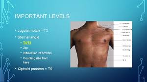 Any short, narrow, v shaped deviation, whether positive or negative, in a linear tracing. What Is A Jugular Notch