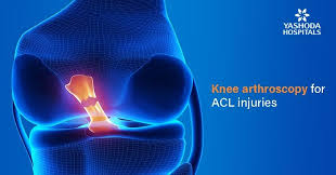 Before i get into answering the question, what is an acl tear?. Anterior Cruciate Ligament Tear Acl Injuries Symptoms Diagnosis And Treatment