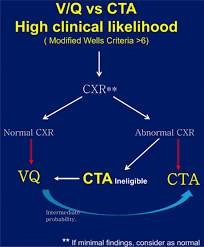 Guideline For Ventilation Perfusion Scintigraphy