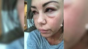 Michelle Heaton left 'days from death' battling alcohol addiction