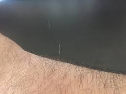 I really loved my long hair, but i think the fresh cut fits me. What Causes Single Long White Hair In My Face Or Ear Quora