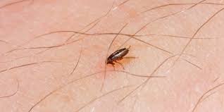 Many species of flea can live for months at a time on a diet of human blood. Flea Bites In Humans How To Treat Them And Get Rid Of An Infestation