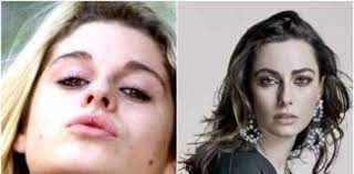 28 de febrero, 2020 | por the clinic. Pablo Mackenna Archivos Pagina 2 De 3 Te Cache Farandula Y Espectaculos Desde Chile