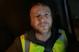 I am daniel bodnar ретвитнул(а) evan you. Renowned Environmental Activist Daniel Bodnar Suffered A Serious Accident He Has A Broken Spine